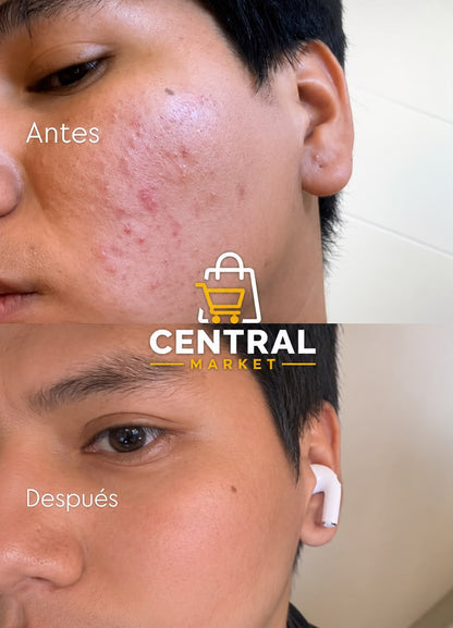 COLAGENO RENOVA +